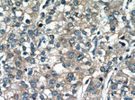 MGME1 Antibody in Immunohistochemistry (Paraffin) (IHC (P))