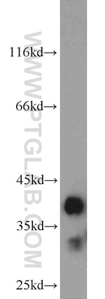 MGME1 Antibody in Western Blot (WB)