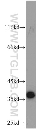 MGME1 Antibody in Western Blot (WB)