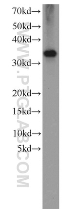 MGME1 Antibody in Western Blot (WB)