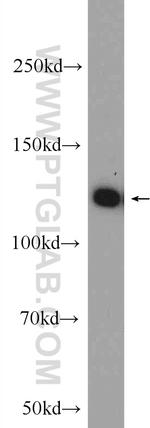 C20orf194 Antibody in Western Blot (WB)