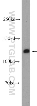 C20orf194 Antibody in Western Blot (WB)