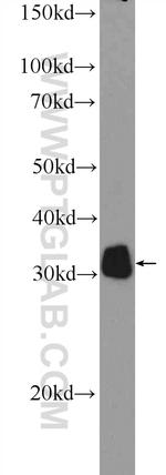 P4HA3 Antibody in Western Blot (WB)