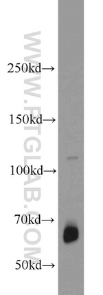 ZGPAT Antibody in Western Blot (WB)