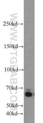 ZGPAT Antibody in Western Blot (WB)