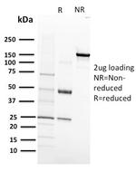 VEGF-R1/FLT-1 Antibody in SDS-PAGE (SDS-PAGE)