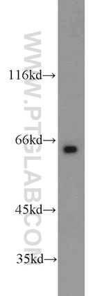 LRRC47 Antibody in Western Blot (WB)