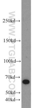 LRRC47 Antibody in Western Blot (WB)