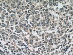 ATG2A Antibody in Immunohistochemistry (Paraffin) (IHC (P))