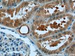 ATG2A Antibody in Immunohistochemistry (Paraffin) (IHC (P))