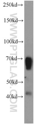 TBX18 Antibody in Western Blot (WB)