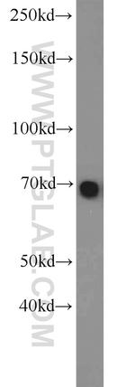 TBX18 Antibody in Western Blot (WB)