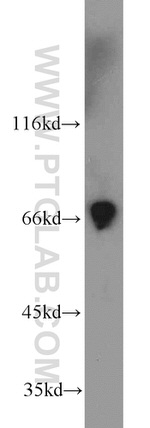 TBX18 Antibody in Western Blot (WB)