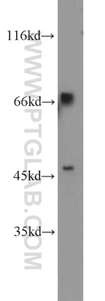 TBX18 Antibody in Western Blot (WB)