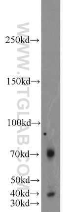 TBX18 Antibody in Western Blot (WB)