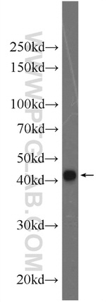 KCNN4 Antibody in Western Blot (WB)