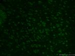 PINK1 Antibody in Immunohistochemistry (PFA fixed) (IHC (PFA))