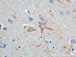 PINK1 Antibody in Immunohistochemistry (Paraffin) (IHC (P))