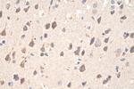 PINK1 Antibody in Immunohistochemistry (Paraffin) (IHC (P))