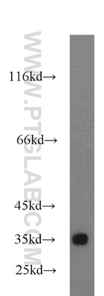 PINK1 Antibody in Western Blot (WB)