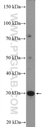 PINK1 Antibody in Western Blot (WB)