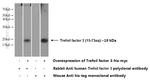 Trefoil factor 3 Antibody in Western Blot (WB)