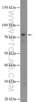 TICAM1 Antibody in Western Blot (WB)