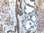 Angiopoietin 1 Antibody in Immunohistochemistry (Paraffin) (IHC (P))