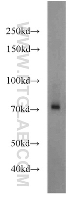 Angiopoietin 1 Antibody in Western Blot (WB)