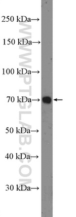 Angiopoietin 1 Antibody in Western Blot (WB)