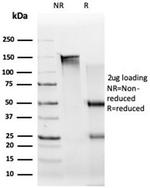 UBR2/E3 ubiquitin-protein ligase UBR2 (Transcription Factor) Antibody in SDS-PAGE (SDS-PAGE)