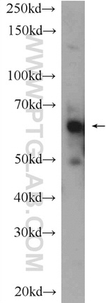 BCMO1 Antibody in Western Blot (WB)