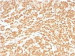 ICOS-L/ICOS Ligand/B7RP-1 (Immuno-Oncology Target) Antibody in Immunohistochemistry (Paraffin) (IHC (P))