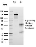 ICOS-L/ICOS Ligand/B7RP-1 (Immuno-Oncology Target) Antibody in SDS-PAGE (SDS-PAGE)