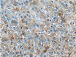 IDH1 Antibody in Immunohistochemistry (Paraffin) (IHC (P))