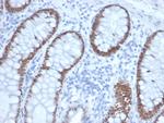 SATB2 (Colorectal Carcinoma Marker) Antibody in Immunohistochemistry (Paraffin) (IHC (P))