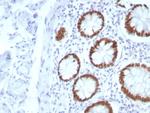 SATB2 (Colorectal Carcinoma Marker) Antibody in Immunohistochemistry (Paraffin) (IHC (P))