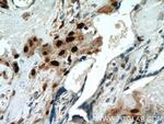 p57Kip2 Antibody in Immunohistochemistry (Paraffin) (IHC (P))