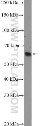 p57Kip2 Antibody in Western Blot (WB)