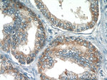 Eg5 Antibody in Immunohistochemistry (Paraffin) (IHC (P))