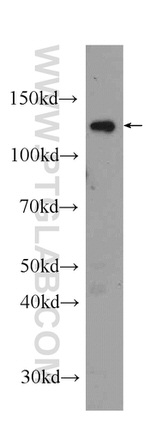 Eg5 Antibody in Western Blot (WB)