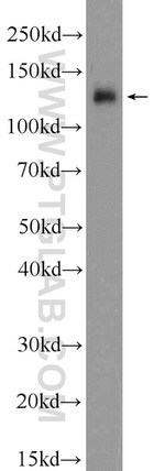 Eg5 Antibody in Western Blot (WB)