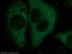 Eg5 Antibody in Immunocytochemistry (ICC/IF)