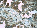 Eg5 Antibody in Immunohistochemistry (Paraffin) (IHC (P))