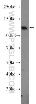 Eg5 Antibody in Western Blot (WB)