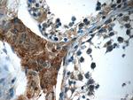 C16orf84 Antibody in Immunohistochemistry (Paraffin) (IHC (P))