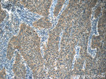 KDELC2 Antibody in Immunohistochemistry (Paraffin) (IHC (P))