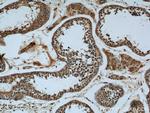 KDELC2 Antibody in Immunohistochemistry (Paraffin) (IHC (P))