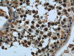 KDELC2 Antibody in Immunohistochemistry (Paraffin) (IHC (P))