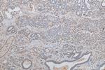 KDELC2 Antibody in Immunohistochemistry (Paraffin) (IHC (P))